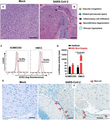 Mast cell activation triggered by SARS-CoV-2 causes inflammation in brain microvascular endothelial cells and microglia